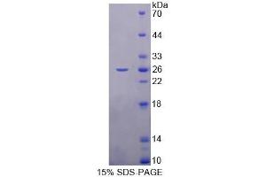 SDS-PAGE analysis of Rat RBP3 Protein.