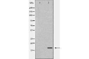 anti-Transforming Growth Factor, alpha (TGFA) (C-Term) antibody