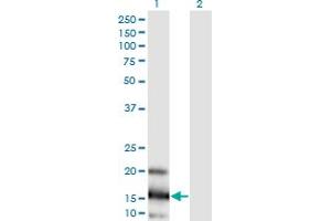 Western Blot analysis of LOC402176 expression in transfected 293T cell line by LOC402176 monoclonal antibody (M03), clone 3E7. (RPL21P44 anticorps  (AA 1-136))