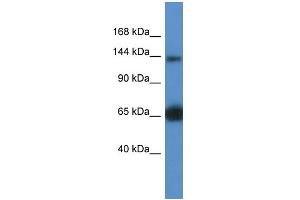WB Suggested Anti-Rapgef2 Antibody   Titration: 1. (RAPGEF2 anticorps  (Middle Region))