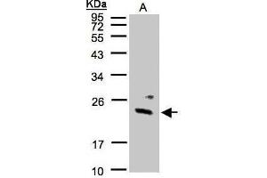 WB Image Sample(30 μg of whole cell lysate) A:293T 12% SDS PAGE antibody diluted at 1:1000 (GUK1 anticorps)