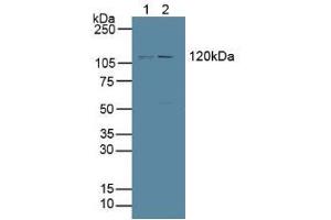 Figure. (PTPRH anticorps  (AA 844-1096))