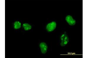 Immunofluorescence of monoclonal antibody to MKNK1 on HeLa cell. (MKNK1 anticorps  (AA 1-465))