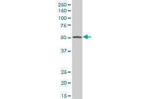 TGFBR1 polyclonal antibody (A01), Lot # ABNOVA060606QCS1 Western Blot analysis of TGFBR1 expression in HepG2 .