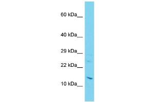 Host: Rabbit Target Name: C11orf1 Sample Type: Jurkat Whole Cell lysates Antibody Dilution: 1. (C11orf1 anticorps  (C-Term))