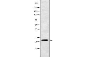 Western blot analysis of CIB4 using MCF7 whole cell lysates (CIB4 anticorps  (C-Term))