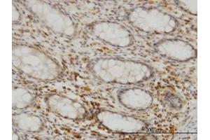 Image no. 3 for anti-Selenophosphate Synthetase 2 (SEPHS2) (AA 61-151) antibody (ABIN599185) (SEPHS2 anticorps  (AA 61-151))