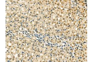 ABIN6259857 and ABIN6266711 at 1/100 staining Mouse brain tissue by IHC-P. (AKAP8 anticorps  (Internal Region))
