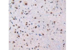 IHC-P analysis of spinal cord tissue, with DAB staining.