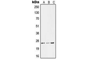 Western blot analysis of Kallikrein 11 expression in HeLa LPS-treated (A), SP2/0 UV-treated (B), PC12 LPS-treated (C) whole cell lysates. (Kallikrein 11 anticorps  (Center))