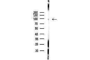 anti-Trimethylguanosine Synthase 1 (TGS1) antibody