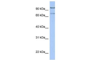WB Suggested Anti-LCMT2 Antibody Titration:  0. (LCMT2 anticorps  (C-Term))