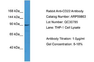 WB Suggested Anti-CD22  Antibody Titration: 0. (CD22 anticorps  (N-Term))