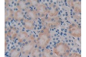 Detection of PDHX in Mouse Kidney Tissue using Polyclonal Antibody to Pyruvate Dehydrogenase Complex Component X (PDHX) (PDHX anticorps  (AA 222-471))