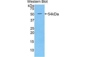 Western Blotting (WB) image for anti-Wingless-Type MMTV Integration Site Family, Member 10A (WNT10A) (AA 108-343) antibody (ABIN3202078) (WNT10A anticorps  (AA 108-343))
