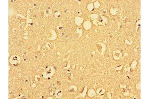 Immunohistochemistry of paraffin-embedded human brain tissue using ABIN7153215 at dilution of 1:100