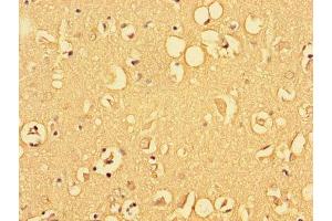 Immunohistochemistry of paraffin-embedded human brain tissue using ABIN7153215 at dilution of 1:100 (ALDOC anticorps  (AA 190-354))