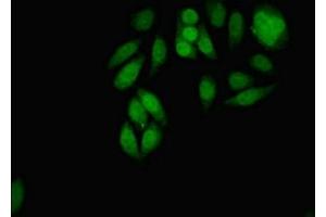 Immunofluorescent analysis of A549 cells using ABIN7159096 at dilution of 1:100 and Alexa Fluor 488-congugated AffiniPure Goat Anti-Rabbit IgG(H+L) (MDC1 anticorps  (AA 1892-2082))