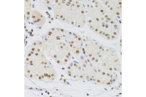 Immunohistochemistry of paraffin-embedded human stomach using HNRNPA1 Antibody (ABIN5975570) at dilution of 1/100 (40x lens). (HNRNPA1 anticorps)