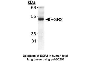 Image no. 1 for anti-Early Growth Response 2 (EGR2) (AA 200-300) antibody (ABIN363607) (EGR2 anticorps  (AA 200-300))
