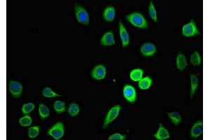 Immunofluorescent analysis of A549 cells using ABIN7164562 at dilution of 1:100 and Alexa Fluor 488-congugated AffiniPure Goat Anti-Rabbit IgG(H+L) (ZDHHC1 anticorps  (AA 283-389))