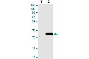 Western blot analysis of Lane 1: Negative control (vector only transfected HEK293T lysate), Lane 2: Over-expression Lysate (Co-expressed with a C-terminal myc-DDK tag (~3. (TVP23C/FAM18B2 anticorps)