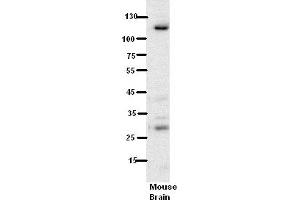 WB Suggested Anti-N6AMT1 Antibody Titration:  5% Milk  ELISA Titer:  dilution: 1:500  Positive Control:  Mouse Brain lysate (N6AMT1 anticorps  (N-Term))