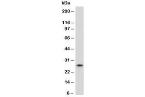 Western blot analysis of human spleen tissue and Kappa antibody. (Souris anti-Humain Immunoglobulin kappa Chain Complex (Igk) Anticorps)