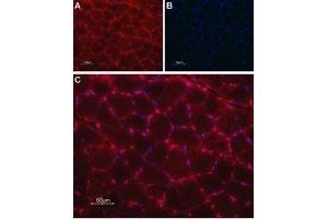 Expression of TRIC-A in rat skeletal muscle - Immunohistochemical staining of paraffin-embedded rat skeletal muscle sections using Anti-TRIC-A (TMEM38A) Antibody (ABIN7043861 and ABIN7045315), followed by goat anti-rabbit-AlexaFluor-594 secondary antibody.