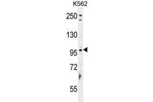 TAS1R2 Antibody (C-term) western blot analysis in K562 cell line lysates (35µg/lane).