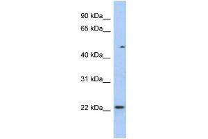 WB Suggested Anti-TCEAL3 Antibody Titration:  0.