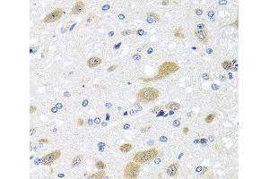 Immunohistochemistry of paraffin-embedded Rat brain using LCAT Polyclonal Antibody at dilution of 1:100 (40x lens). (LCAT anticorps)