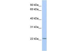 WB Suggested Anti-HIST1H1T Antibody Titration: 0. (Histone Cluster 1, H1t (HIST1H1T) (Middle Region) anticorps)