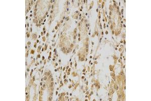 Immunohistochemistry of paraffin-embedded human stomach using HDAC6 antibody (ABIN5997884) at dilution of 1/100 (40x lens). (HDAC6 anticorps)