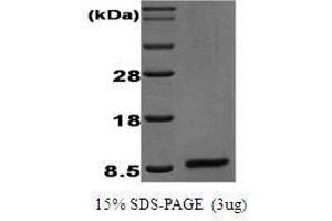 Figure annotation denotes ug of protein loaded and % gel used. (EGF Protéine)