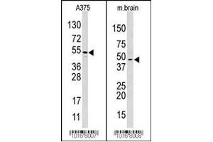 Western blot analysis of anti-HIF1AN Pab in A375 and mouse brain cell line lysate (HIF1AN anticorps  (C-Term))