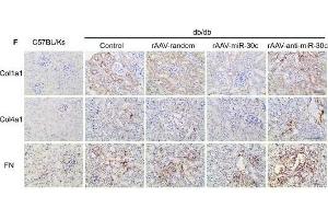 MiR-30c reduced fibrosis in DN via reducing TGF-β1 secretion from TECs. (COL4A1 anticorps  (AA 1445-1669))