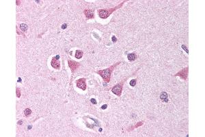 Anti-PPP4C antibody IHC of human brain, cortex. (PPP4C anticorps  (AA 294-307))