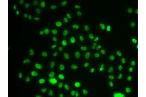 Immunofluorescence analysis of MCF-7 cells using PHIP antibody (ABIN6129078, ABIN6145556, ABIN6145557 and ABIN6223036). (PHIP anticorps  (AA 1542-1821))