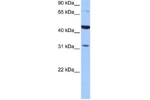 WB Suggested Anti-TPRXL Antibody Titration:  0.