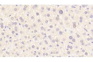 Detection of PROC in Mouse Liver Tissue using Polyclonal Antibody to Protein C (PROC) (PROC anticorps  (AA 197-436))