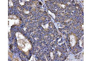 IHC analysis of TFEB using anti-TFEB antibody (ABIN7600648).