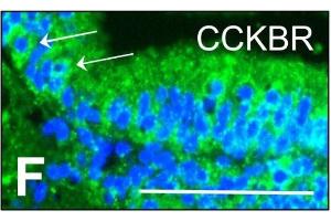 Homogenous, granular expression of CCKBR is seen within the neuroepithelial cells, with intense perinuclear labelling. (CCKBR anticorps  (AA 301-400))