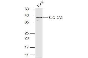 Mouse liver lysate probed with SLC10A2 Polyclonal Antibody  at 1:300 overnight at 4˚C. (SLC10A2 anticorps  (AA 131-230))