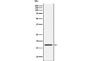 Western blot analysis of FHIT expression in Rat kidney lysate.