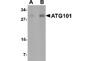 Western Blotting (WB) image for anti-Chromosome 12 Open Reading Frame 44 (C12orf44) (Middle Region) antibody (ABIN1030867) (ATG101 anticorps  (Middle Region))