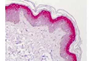 Human Skin: Formalin-Fixed, Paraffin-Embedded (FFPE)