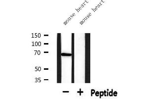 Western blot analysis of extracts from mouse heart, using PIAS3 Antibody. (PIAS3 anticorps  (N-Term))