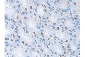 Detection of PDXK in Mouse Stomach Tissue using Polyclonal Antibody to Pyridoxal Kinase (PDXK)