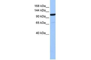 WB Suggested Anti-NUP155 Antibody Titration: 0. (NUP155 anticorps  (Middle Region))